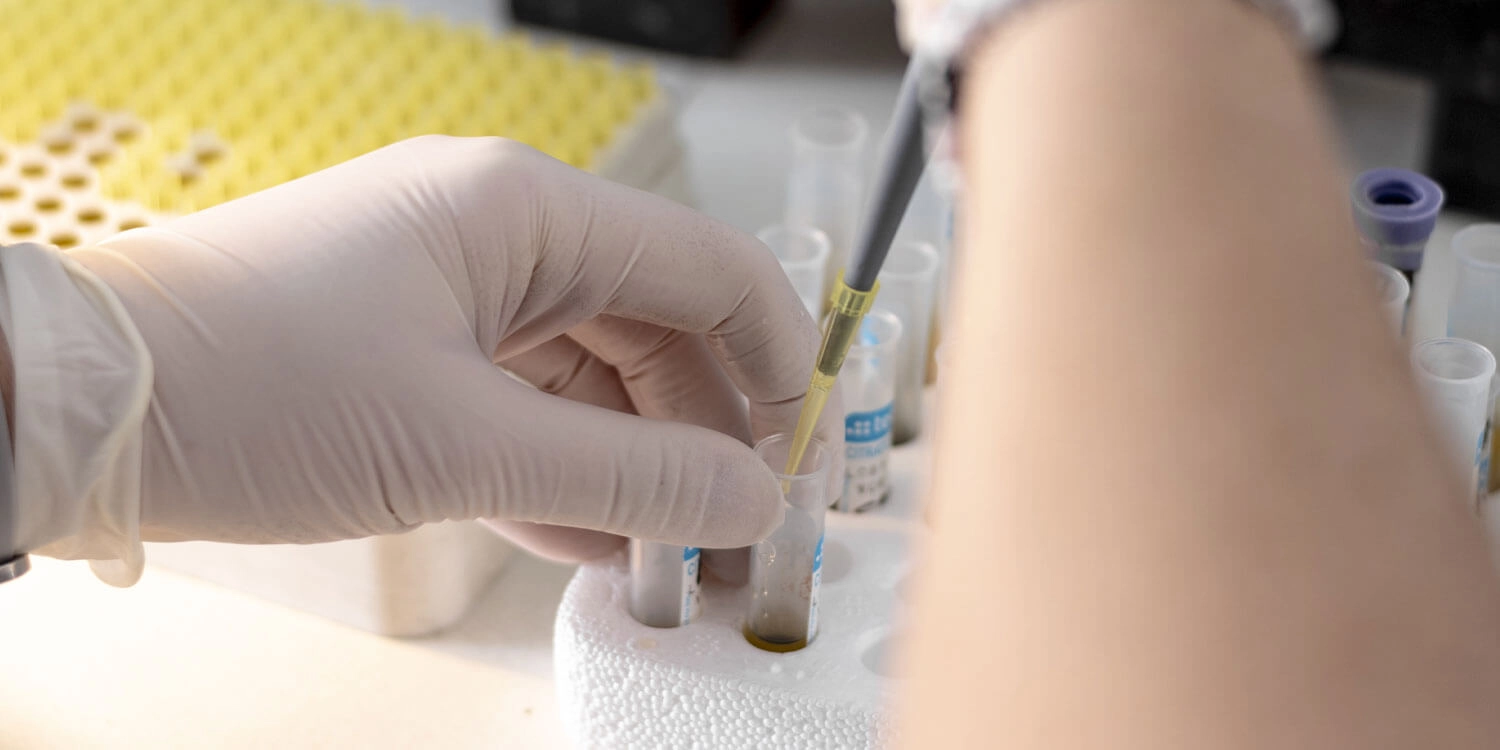 Laboratorio Perez Elizalde - Servicios - Hematologia (2)