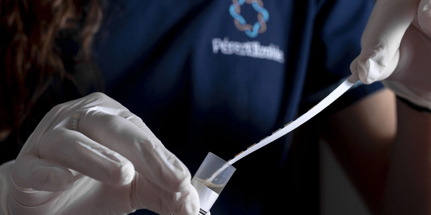 Laboratorio Perez Elizalde - Servicios - Uroanalisis (1)